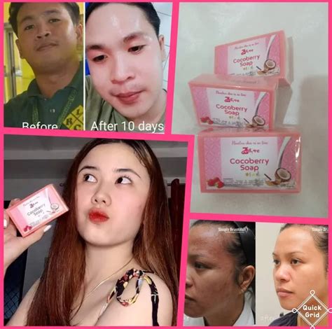 sabon na nakakaputi at nakakatanggal ng peklat|Sabon Pantanggal Sa Peklat .